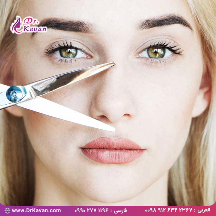 دلایل انتخاب جراحی زیبایی بینی