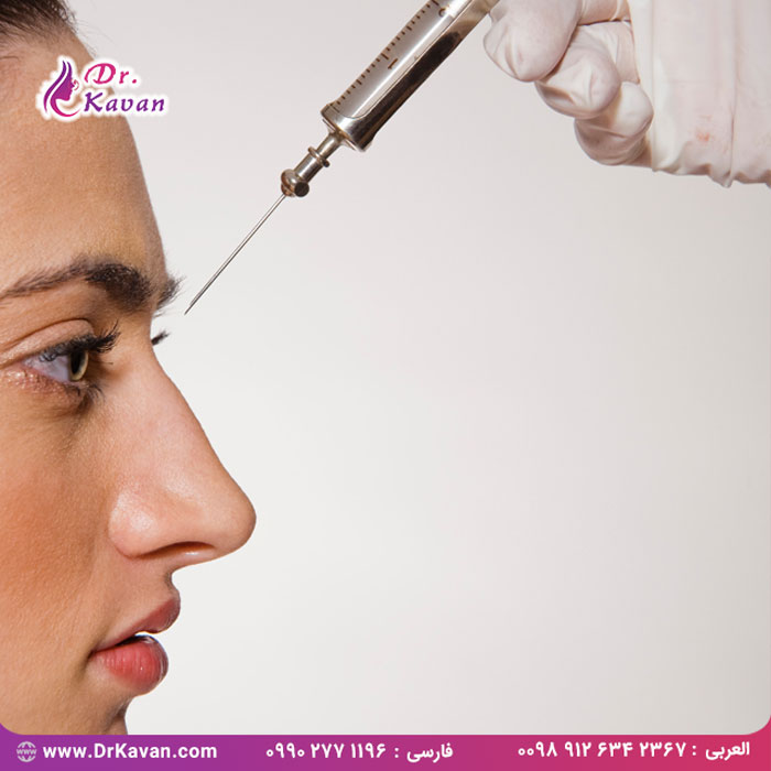 تزریق فیلر بینی