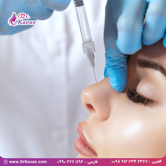 تزریق فیلر بینی