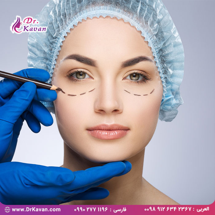 بلفاروپلاستی (جراحی پلک)