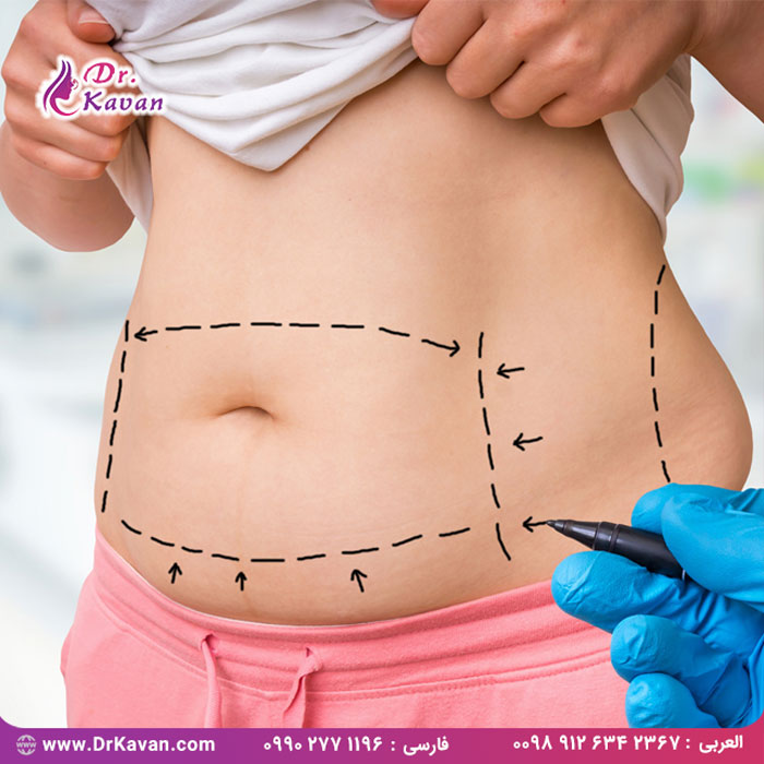 هشت نوع عمل جراحی زیبایی متداول