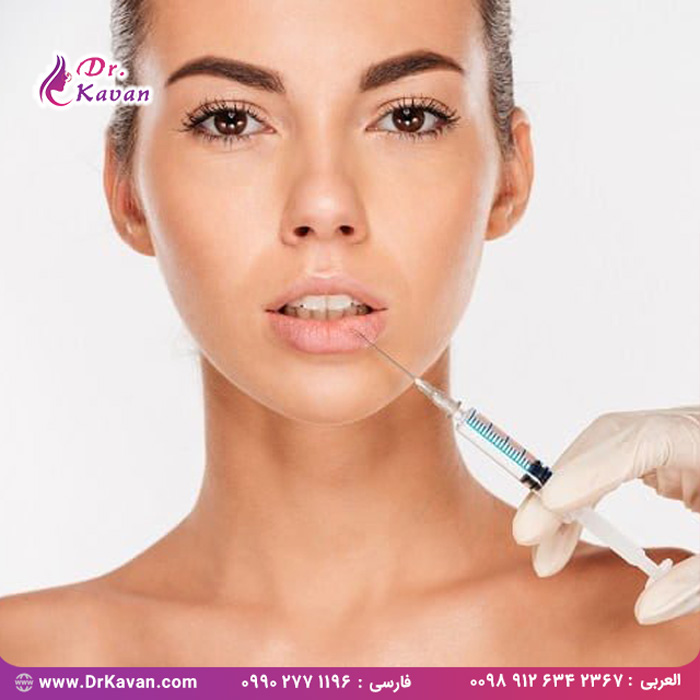 تزریق ژل لب