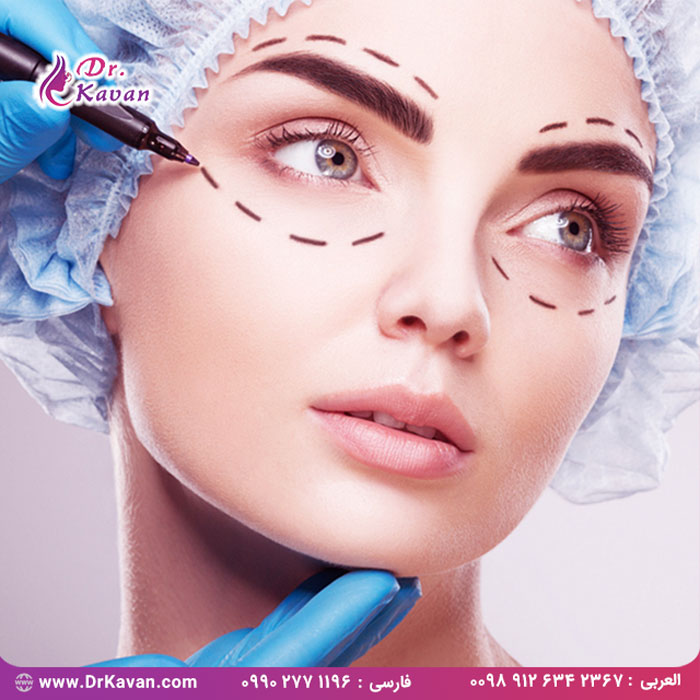 بلفاروپلاستی (جراحی پلک)