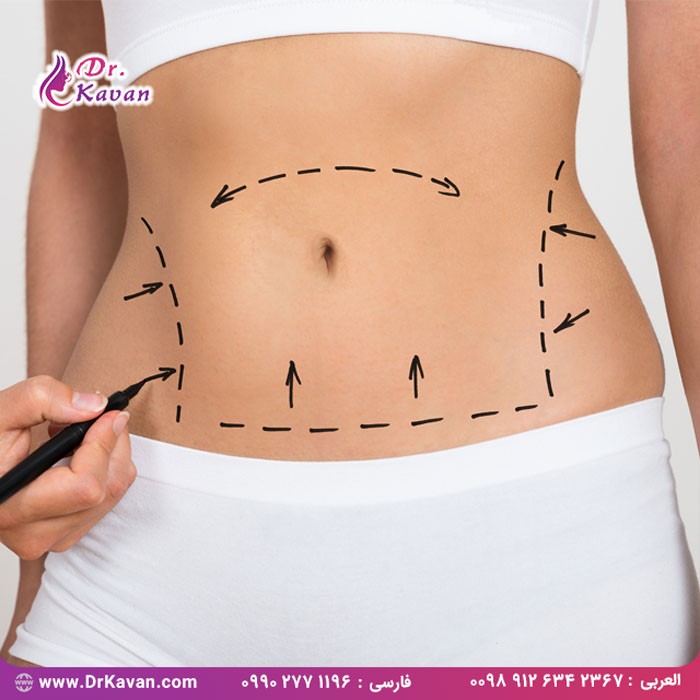 هشت نوع عمل جراحی زیبایی متداول