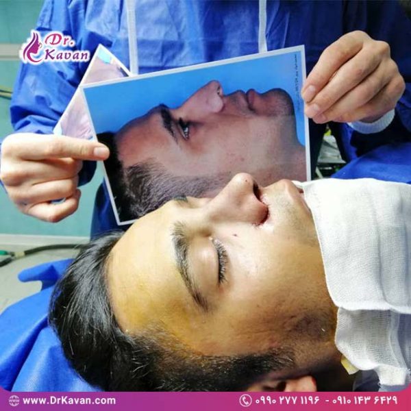 عمل زیبایی بینی