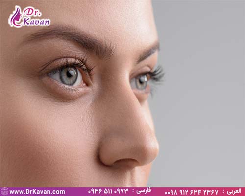 اقدامات قبل از جراحی بینی