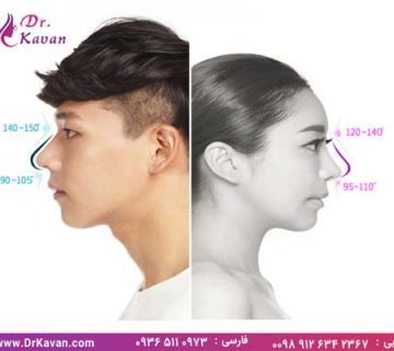 تفاوت جراحی بینی زنان و مردان