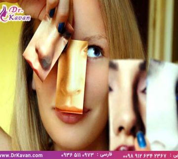 جراحی ترمیم بینی