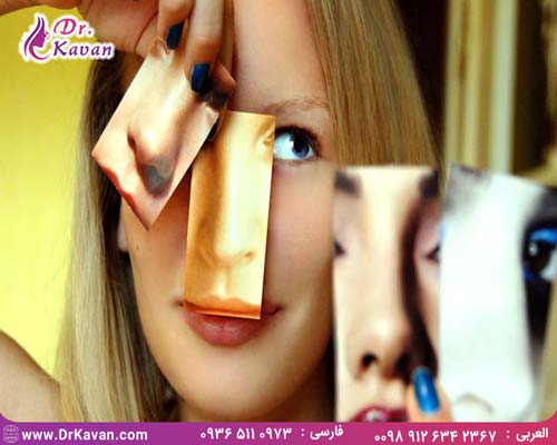 جراحی ترمیم بینی