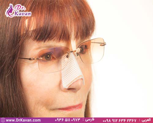 ریکاوری جراحی بینی