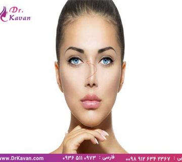 عمل انحراف بینی