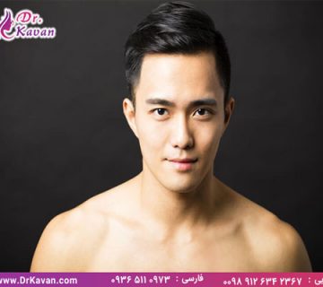 عمل بینی مردانه