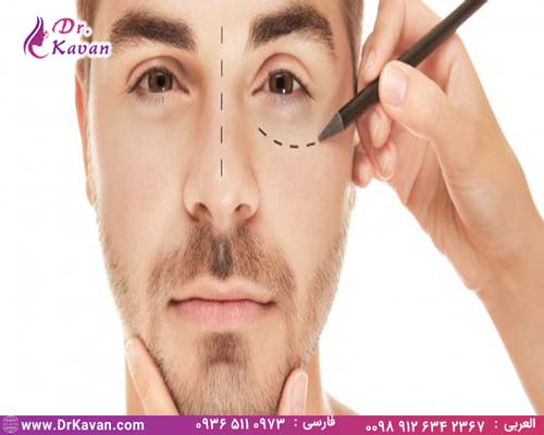عمل بینی یا رینوپلاستی چیست