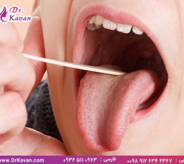 عمل جراحی لوزه