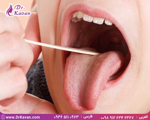 عمل جراحی لوزه