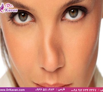 عمل شگستگی بینی