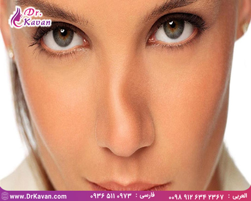 عمل شگستگی بینی