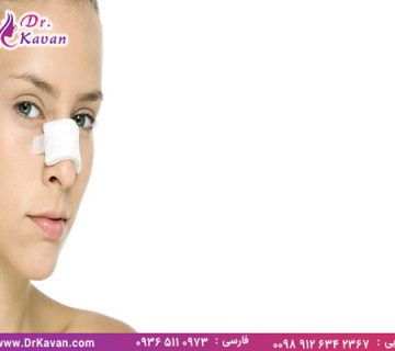 مراقبت های بعد از عمل بینی