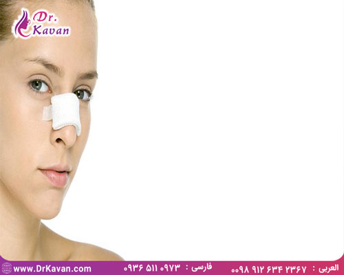 مراقبت های بعد از عمل بینی