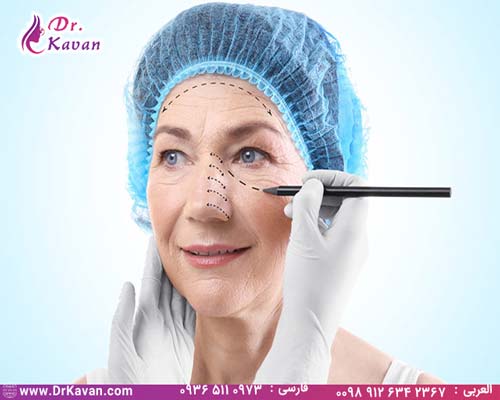 چه افرادی نیاز به عمل بینی دارند
